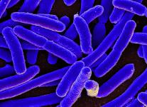 By NIAID - E. coli Bacteria, CC BY 2.0, https://commons.wikimedia.org/w/index.php?curid=39933077