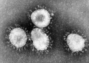 Photo Credit:Content Providers(s): CDC/Dr. Fred Murphy / Public domain;  https://commons.wikimedia.org/wiki/File:Coronaviruses_004_lores.jpg