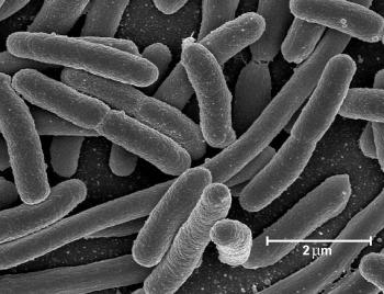 https://www.wikiskripta.eu/w/Infekce_vyvolan%C3%A9_Escherichia_coli#/media/File:Coli3.jpg  Autor: Elapied at French Wikipedia – Transferred from fr.wikipedia to Commons by Bloody-libu using CommonsHelper., Volné dílo, https://commons.wikimedia.org/w/index.php?curid=17955495